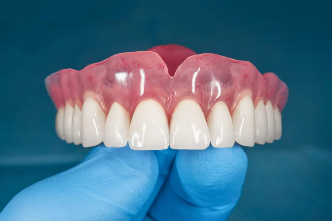 Dentures (gigi palsu) at Dr Feeliz