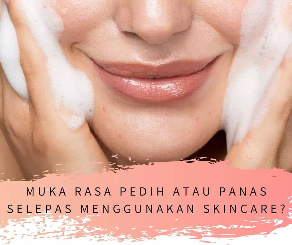 MUKA RASA PEDIH / PANAS SELEPAS GUNA SKINCARE?