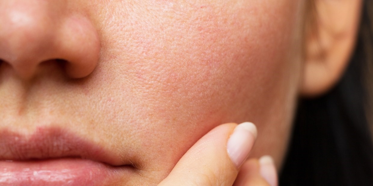 SKINCARE 101: COMBINATION SKIN