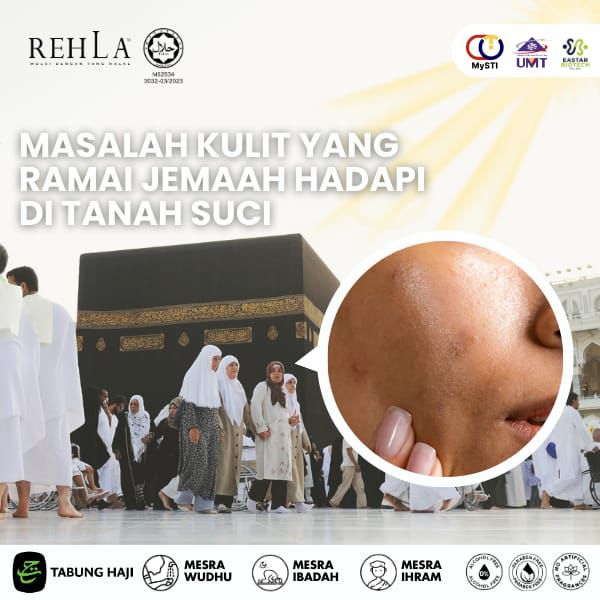 Masalah Kulit Yang Ramai Jemaah Hadapi Di Tanah Suci