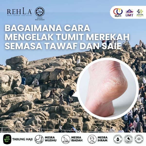 Bagaimana Cara Mengelak Tumit Merekah Semasa Tawaf dan Saie?